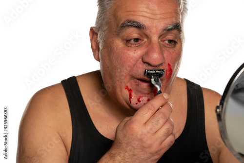  middle aged man with blood on his face