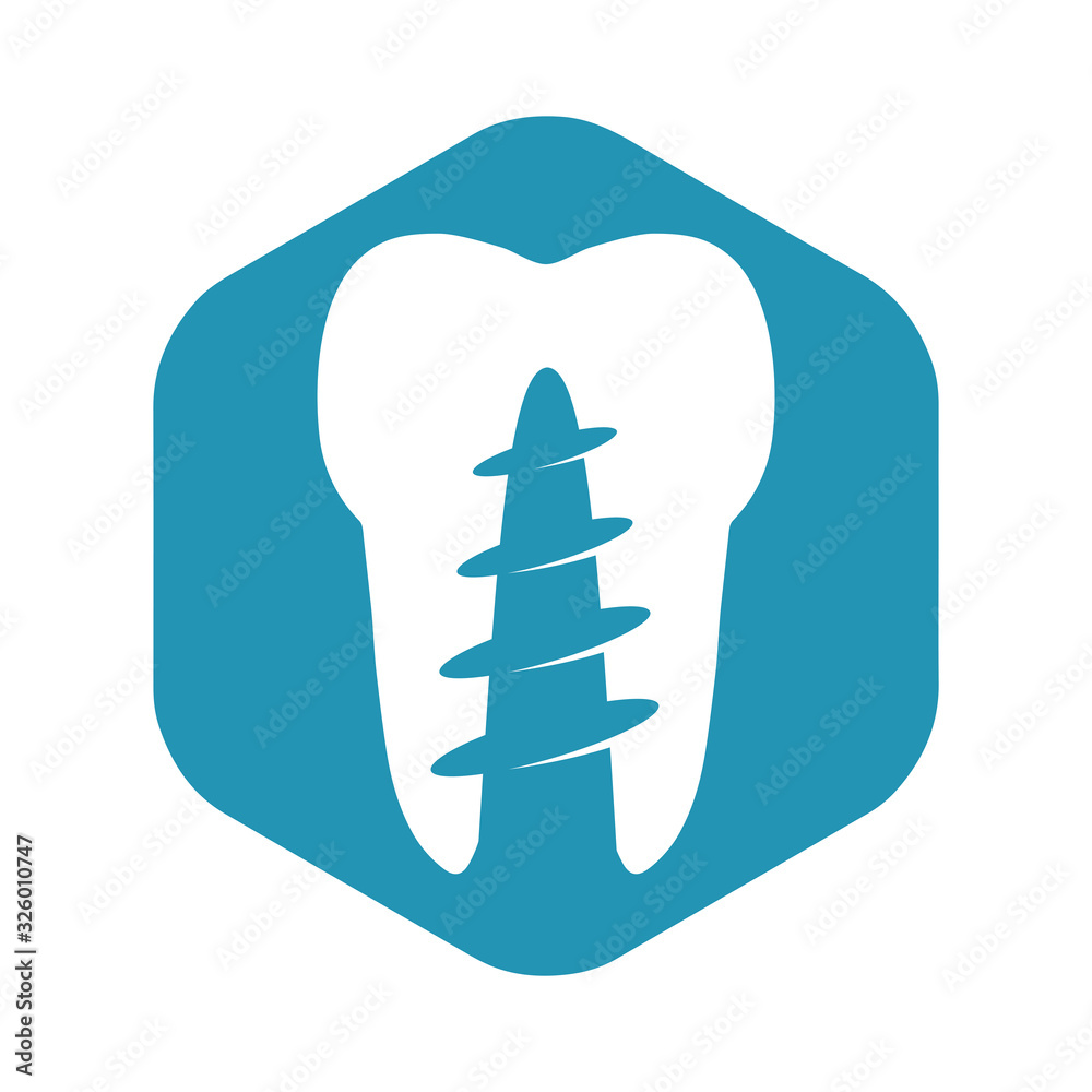 Icon dental implantation and prosthetics. A white tooth with a pin on a blue hexagon. Vector illustration in a simple flat style isolated on a white background. Icon dental implantation and prosthetics. A white tooth with a pin on a blue hexagon. Vector illustration in a simple flat style isolated on a white background.