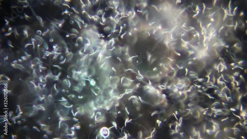 The study of chicken sperm under the microscope view in laboratory.