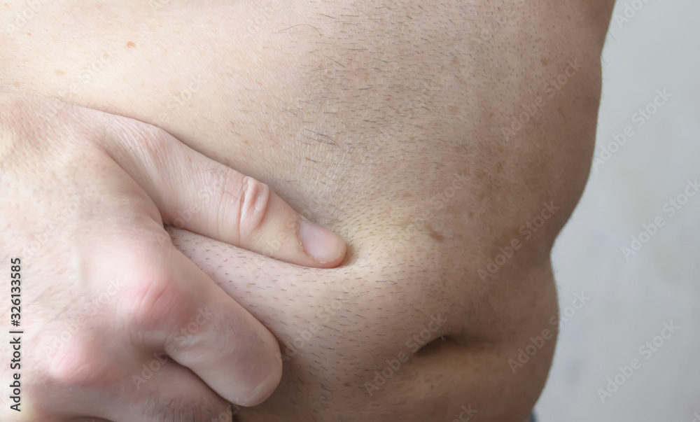 Man fat deposits. Overweight problem.Unhealthy eating.A man holds on to his body's side showing fat deposits Man fat deposits. Overweight problem.Unhealthy eating.A man holds on to his body's side showing fat deposits