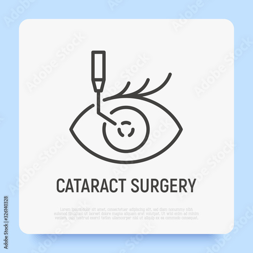 Cataract surgery thin line icon. Ophthalmology. Lasik vision correction. Modern vector illustration.