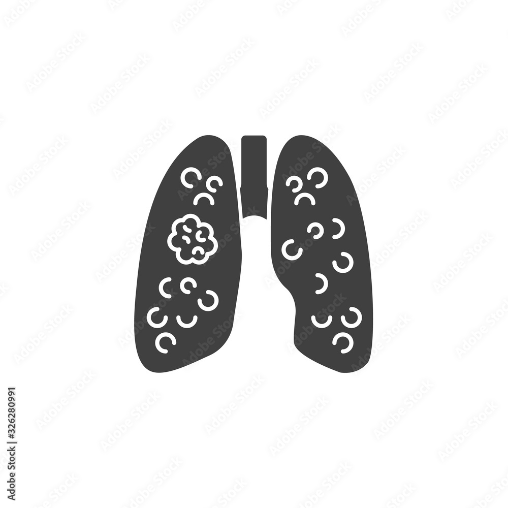 Lung cancer vector icon. filled flat sign for mobile concept and web design. Human lungs cancer glyph icon. Symbol, logo illustration. Vector graphics Lung cancer vector icon. filled flat sign for mobile concept and web design. Human lungs cancer glyph icon. Symbol, logo illustration. Vector graphics