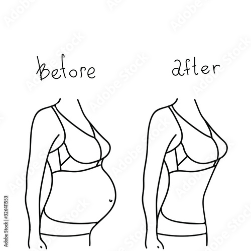 Before and after transformation process. Pregnant woman beauty procedures, Vector stock illustration in doodle style.