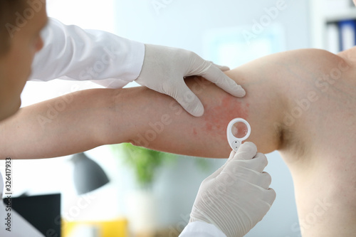 Fotografie Male dermatologist examines rash on his leg