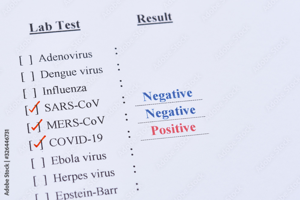 Fototapeta premium Positive test result of COVID-19, novel coronavirus 2019 found in Wuhan, China