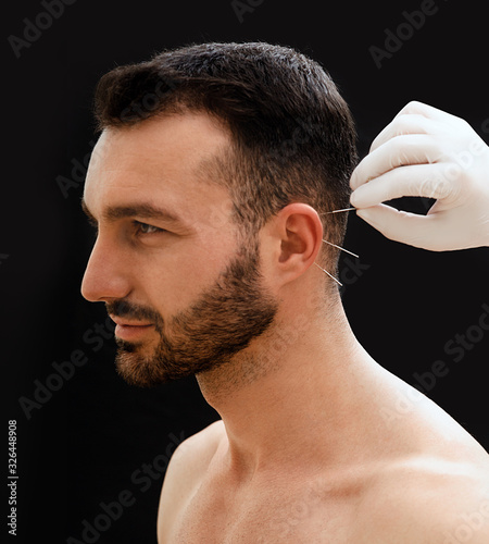 Fotografie Treatment of many diseases by ear acupuncture
