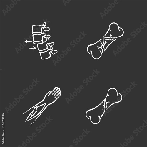 Body part injuries chalk white icons set on black background. Spinal vertebra, spine dislocation. Open fracture. Broken bones. Medical condition. Accident. Isolated vector chalkboard illustrations