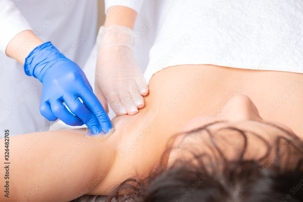 Fototapeta premium Armpit epilation, sugaring or waxing hair removal.