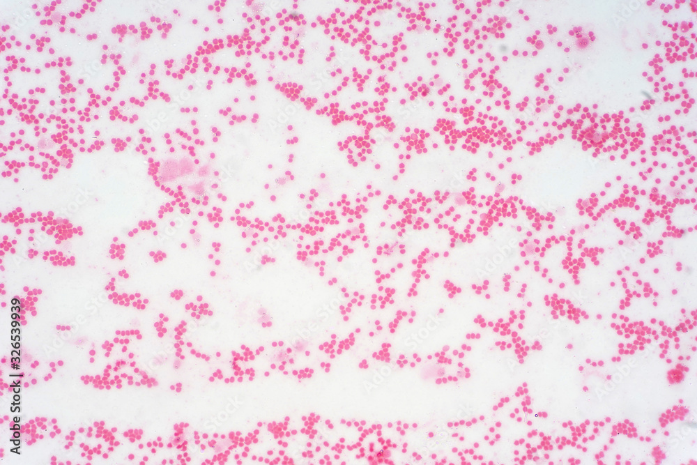 Pathology study of human stem cell under microscope. Pathology study of human stem cell under microscope.