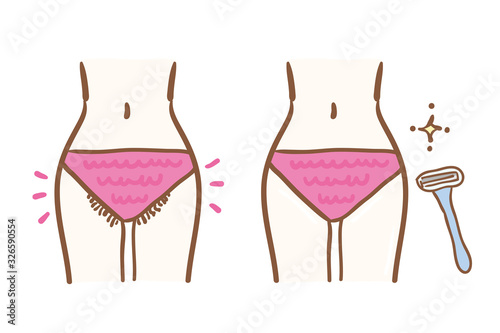 Illustration of pubic hair treatment