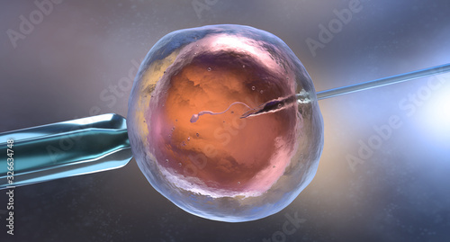 Artificial insemination or in vitro fertilization
