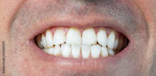 Weisse strahlende Zähne