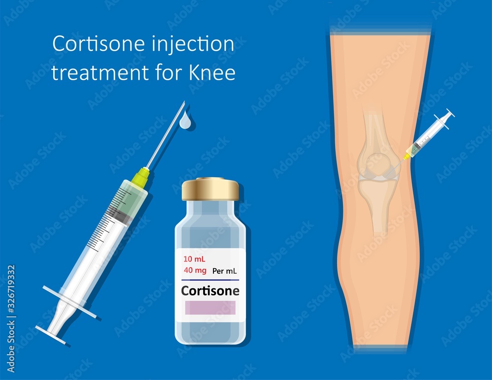 Cortisone shots injection epidural steroid ESI lumbar back spinal