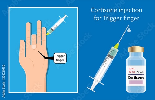 Cortisone shots injection epidural steroid ESI lumbar back spinal nerves anti inflammatory Carpal Tunnel Syndrome tennis elbow symptom swelling chronic discomfort