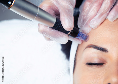 Cosmetologist making mesotherapy injection with dermapen on face for rejuvenation on the spa center. photo