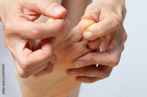 Inspection of the toes with the hands to detect the presence of calluses, warts or athlete's foot photo