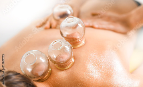 Detail of a woman therapist hands giving cupping treatment on back.