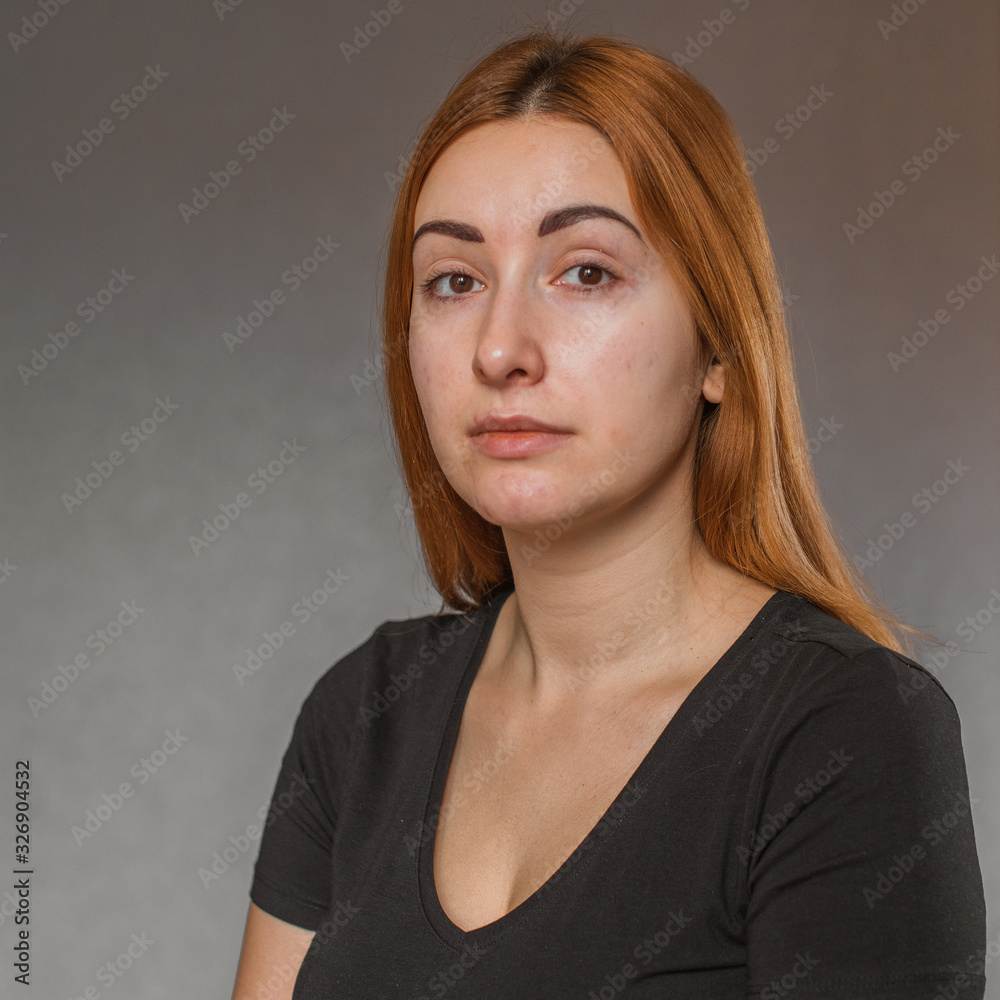 Acne and scars, simple woman close up natural portrait, No makeup and retouch. Problem skin Acne and scars, simple woman close up natural portrait, No makeup and retouch. Problem skin