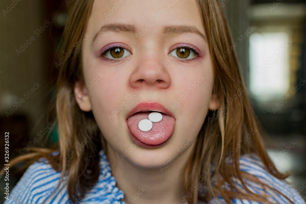 A young girl takes the pills A young girl takes the pills