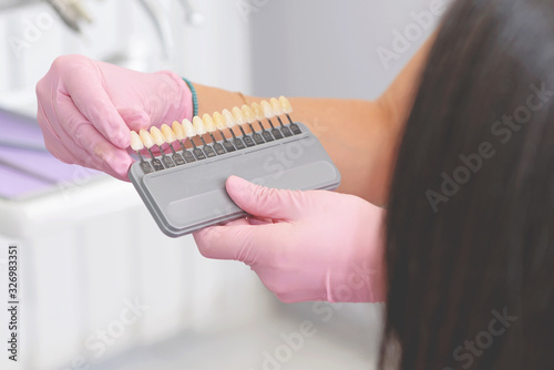 Dental care concept. Dentists hands holding set of implants with various shades of tone and showing to patient