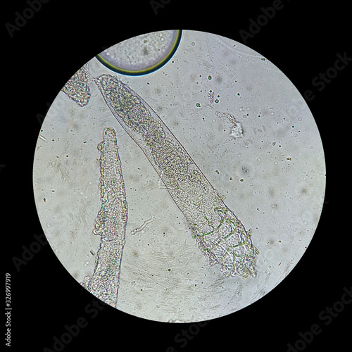 Demodex mite from a microscope view. The parasite causing a skin disease -Demodecosis.