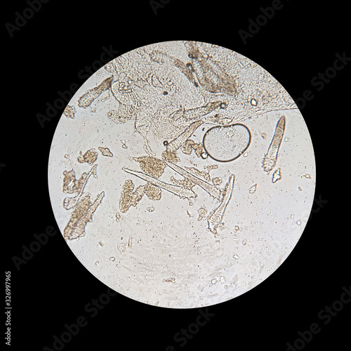 Demodex mite from a microscope view. The parasite causing a skin disease -Demodecosis.