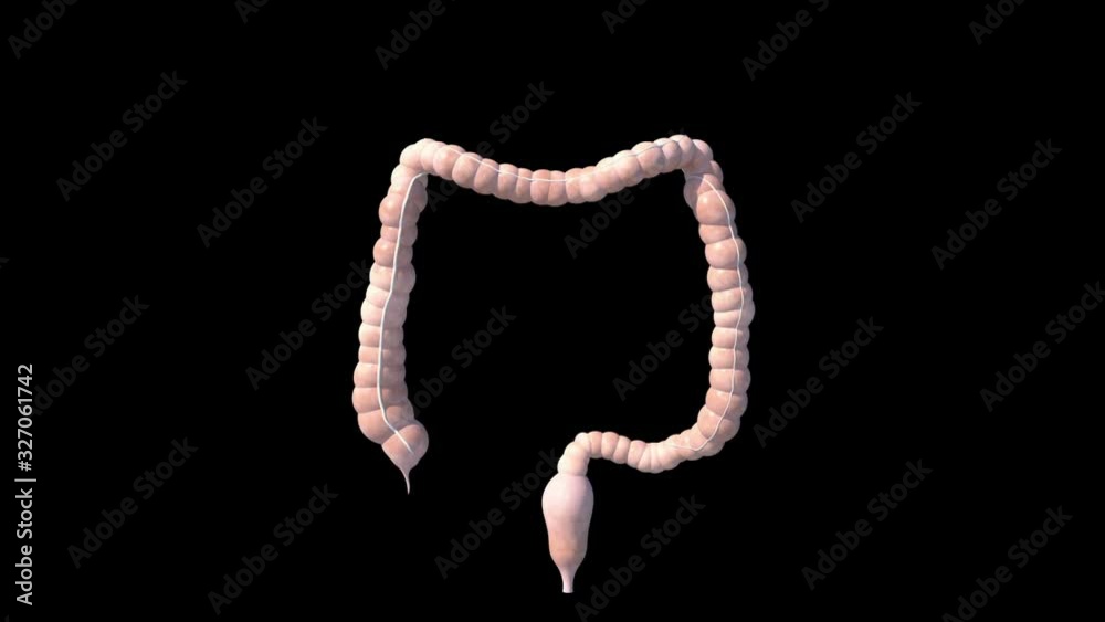 Irritable Bowel
