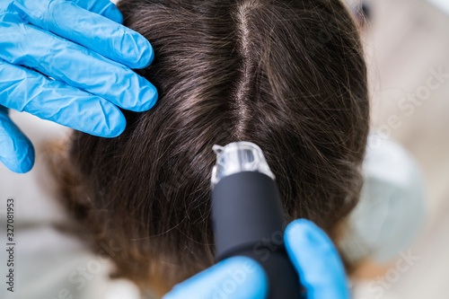 Dermatologist Using Trichoscope For Hair Fall Treatment photo