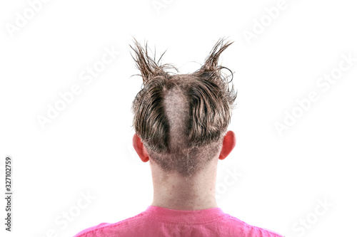 Teen with an odd bad haircut