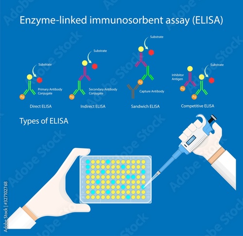 Enzyme linked immunosorbent assay ELISA Immunoassay EIA antibodies infectious technician analyze photo