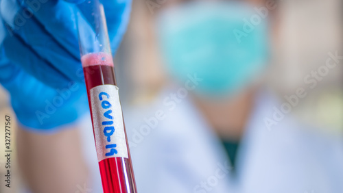Researcher holding test tube blood example covid-19 in the lab