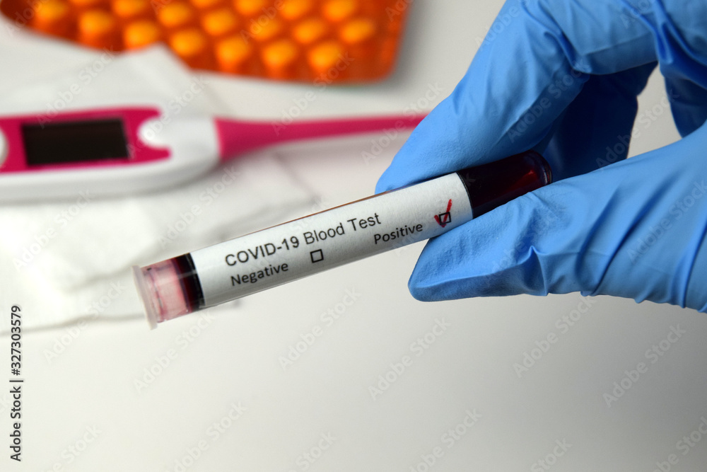 Obraz premium Coronavirus blood test positive