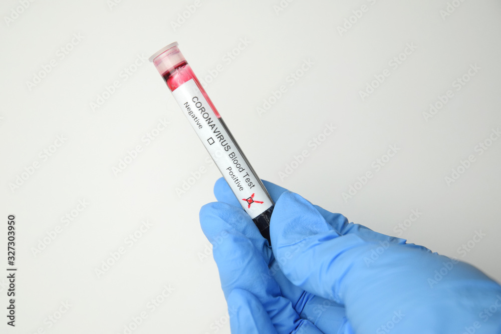 Obraz premium coronavirus looks like a pandemic