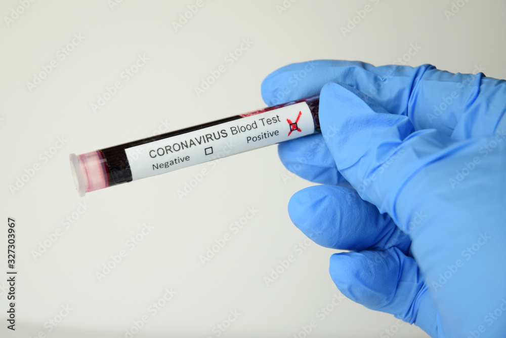 Fototapeta premium coronavirus looks like a pandemic