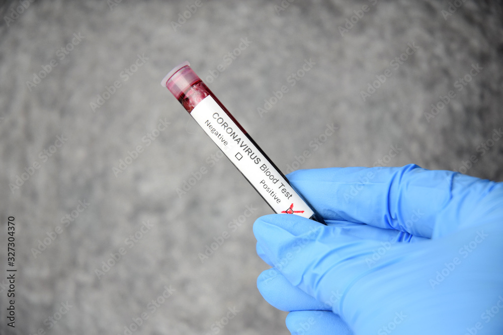 Fototapeta premium Coronavirus COVID