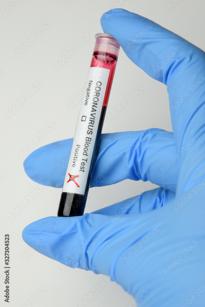 Fototapeta premium Coronavirus COVID