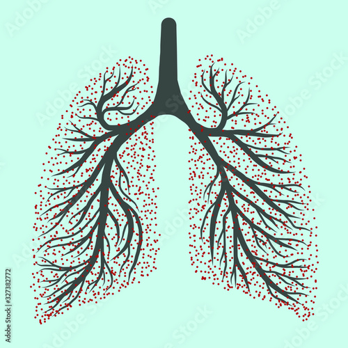 Coronavirus 2019-nCov Virus pulmonary disease drawing illustration of worlwide lung epidemic illness. Corona global probelm spread viral