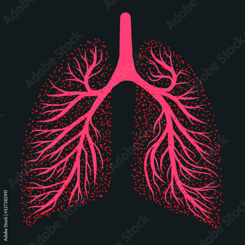 Coronavirus 2019-nCov Virus pulmonary disease drawing illustration of worlwide lung epidemic illness. Corona global probelm spread viral