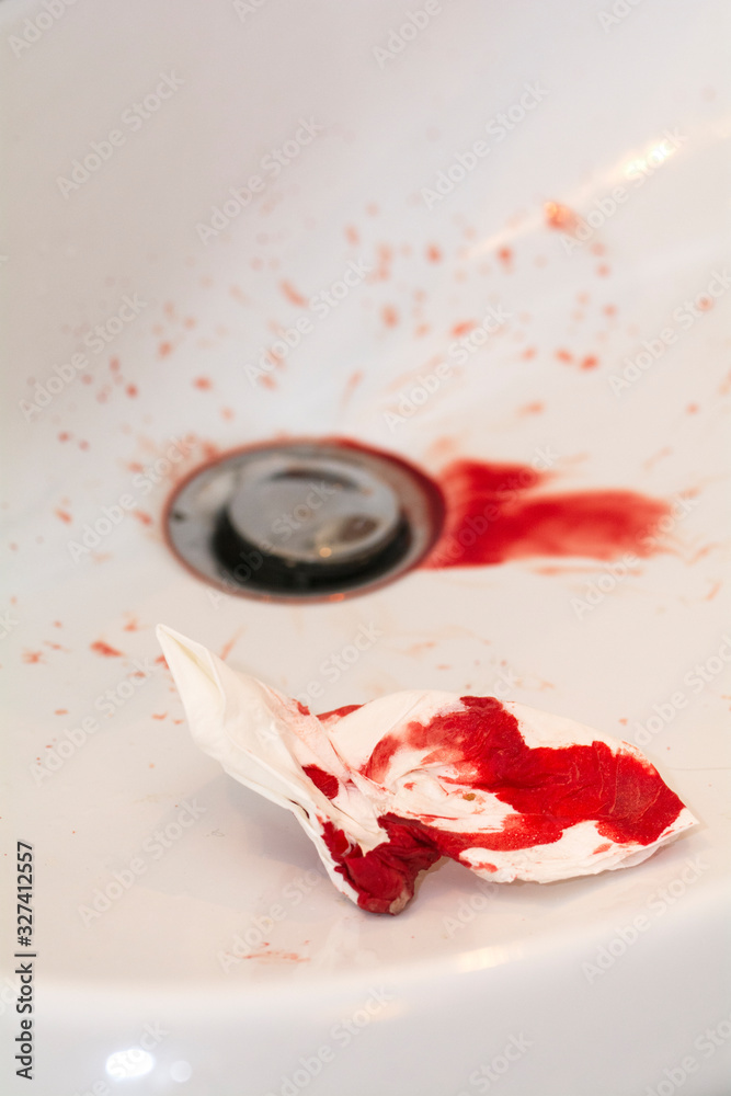 Foto de Nasenbluten - Blutiges Taschentuch im Wachbecken do Stock | Adobe  Stock