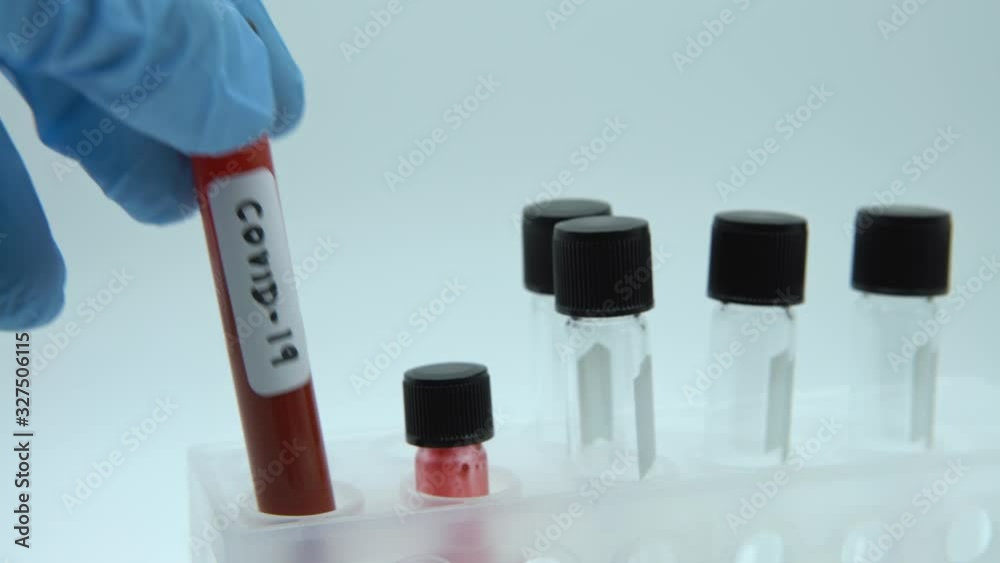 4K, Coronavirus Covid 19 infected blood sample in tube. Vaccine research of virus 2019-nCoV at laboratory. Disease 2019 from Wuhan. Pandemic infectious concept-Dan 4K, Coronavirus Covid 19 infected blood sample in tube. Vaccine research of virus 2019-nCoV at laboratory. Disease 2019 from Wuhan. Pandemic infectious concept-Dan