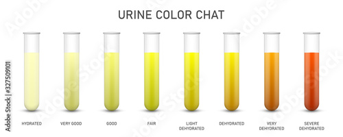 Creative vector illustration of Urine test chat, assessing hydration, dehydration, test tubes isolated on background. Art design pee urine color diagram template. Concept medical biomaterial element