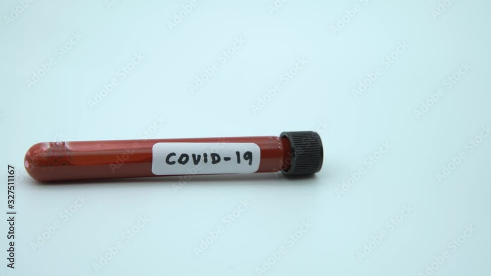 4K, Positive COVID-19 test and laboratory sample of blood testing for diagnosis new Corona virus infection. Disease 2019 from Wuhan. Pandemic infectious concept. 2019-nCoV epidemic of China.-Dan 4K, Positive COVID-19 test and laboratory sample of blood testing for diagnosis new Corona virus infection. Disease 2019 from Wuhan. Pandemic infectious concept. 2019-nCoV epidemic of China.-Dan