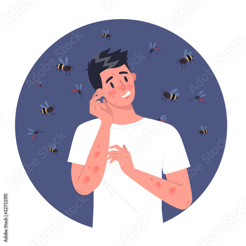 Man with bee allergy. Red and itchy skin. Allergic reaction