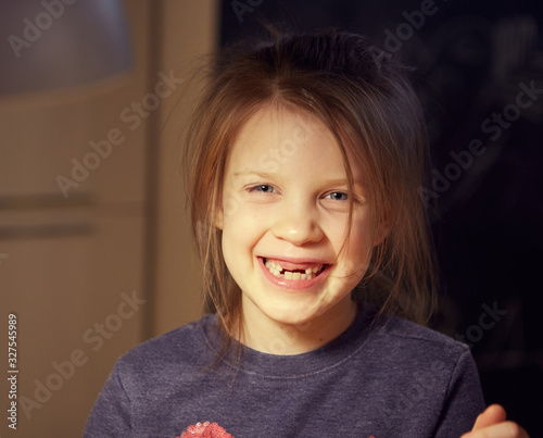 A school-age girl without a front tooths is laughing. Close-up. Change of teeth.