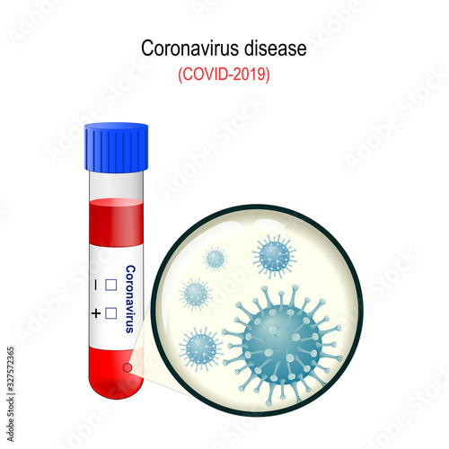 Coronavirus. 2019-nCoV acute respiratory disease. COVID-19.