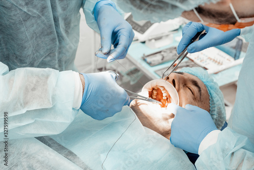 Dentists will perform an operation, implant placement. Real operation. Tooth extraction, implants. Professional uniform and equipment of a dentist. Healthcare Equipping a doctor’s workplace. Dentistry