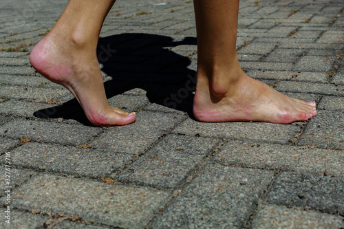 Walking barefoot. Take a step. Red and dry feet walking on bricks.