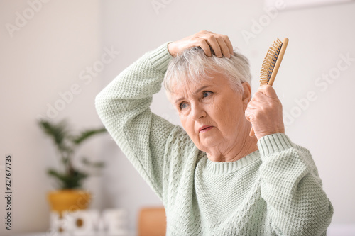 Senior woman with hair loss...