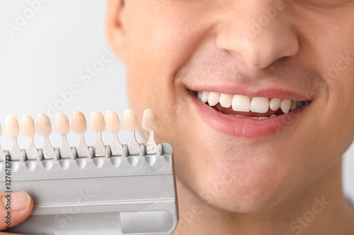 Man with teeth color samples on light background  closeup