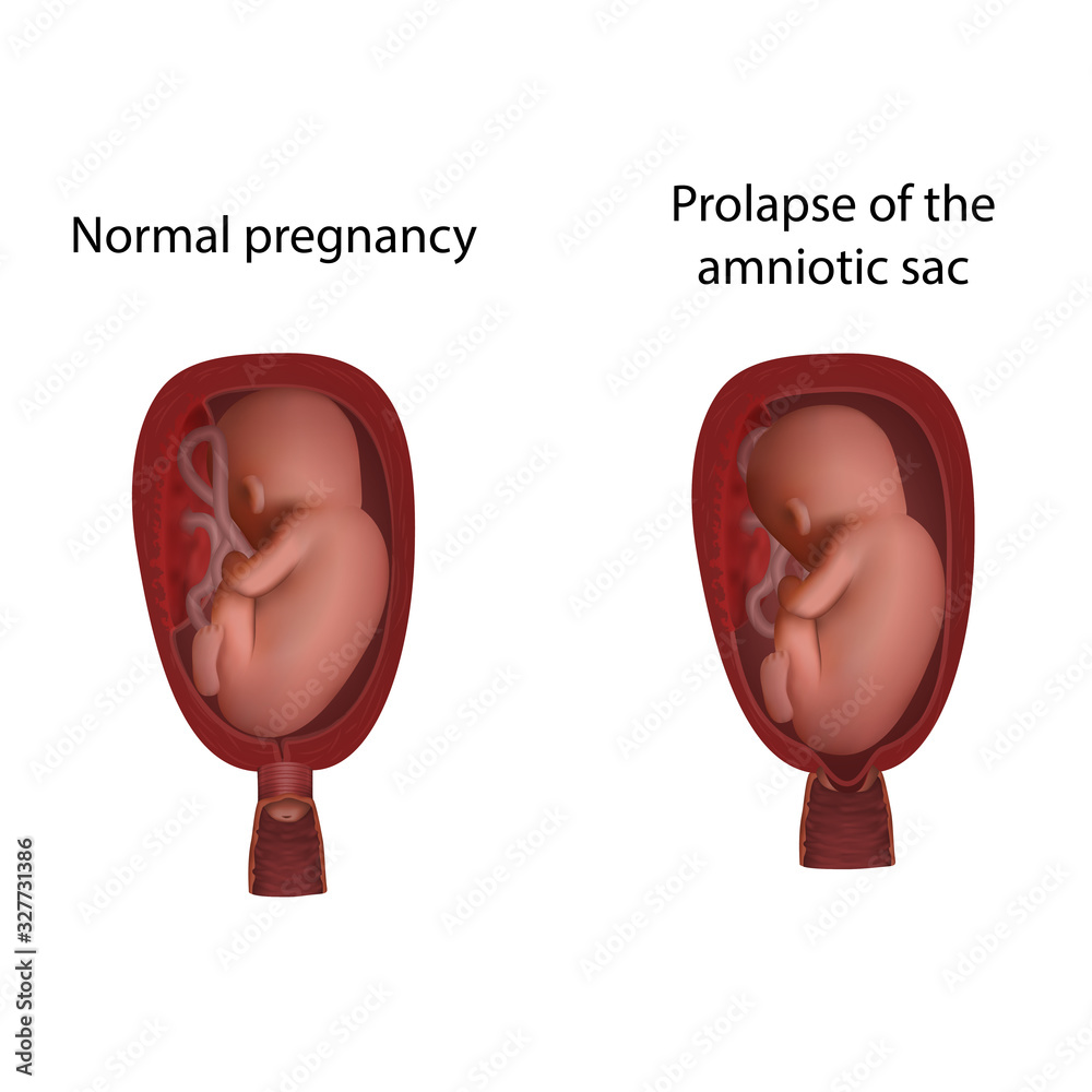 Week 14 of Pregnancy - StoryMD